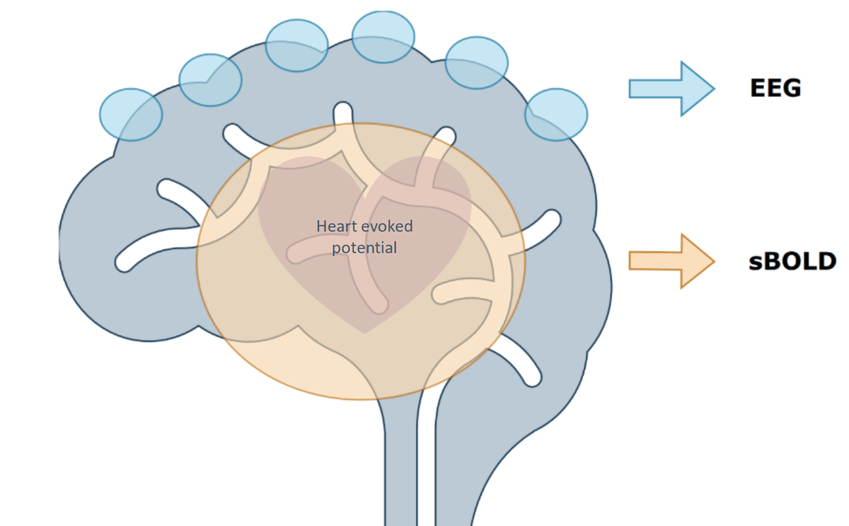 Brain diagram with heart-evoked potential and EEG pathways.